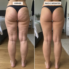 Lade das Bild in den Galerie-Viewer, CelluForm 3D Anti-Cellulite-Leggings
