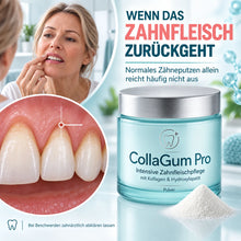 Lade das Bild in den Galerie-Viewer, CollaGum Pro – Kollagen-Zahnfleischpflege für Reparatur, Aufbau & Regeneration