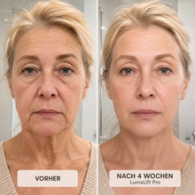 Lade das Bild in den Galerie-Viewer, LumaLift Pro - 3-in-1 Anti-Aging Lifting-Gerät für Gesicht & Körper