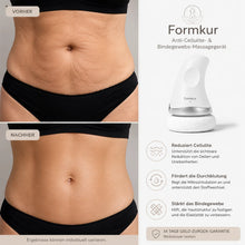 Lade das Bild in den Galerie-Viewer, Formkur - Anti-Cellulite- & Bindegewebs-Massagegerät