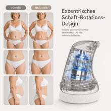 Lade das Bild in den Galerie-Viewer, Formkur - Anti-Cellulite- &amp; Bindegewebs-Massagegerät
